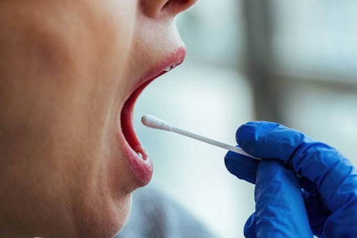 Combien de temps le cbd reste-t-il dans la salive et l’urine ?